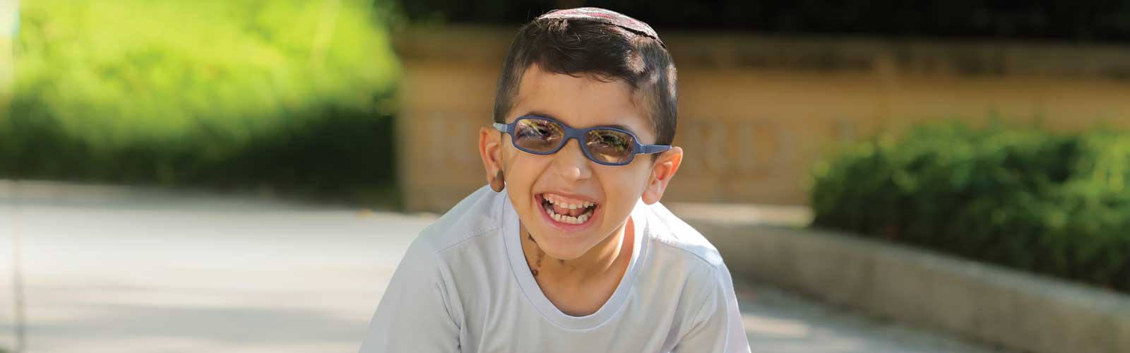A young boy laughs and smiles while playing outside. He wears glasses and a kippa, and has a birthmark on his right ear and on the right side of his neck.