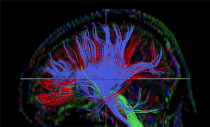 Colorful Brain Scan
