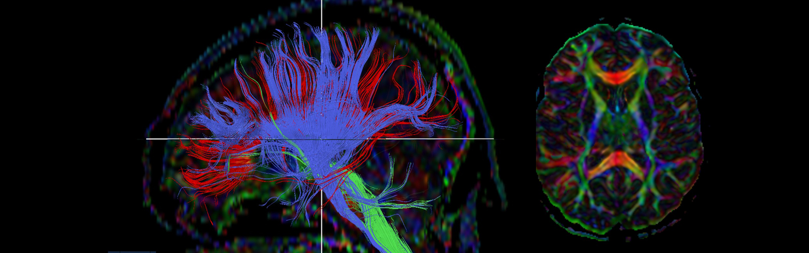 7T MRI Image