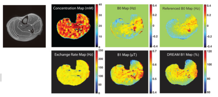 PCr mapping on human skeletal muscle using ANNCEST