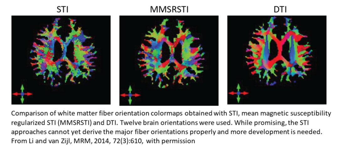 TRD3 Brain Scan