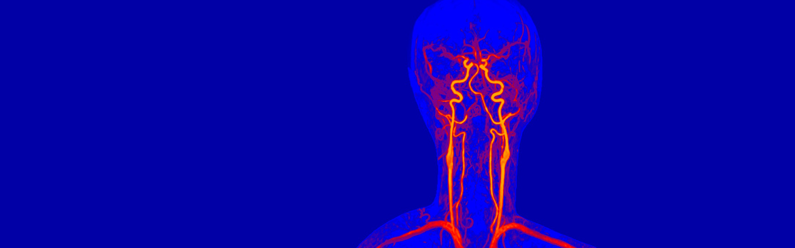 MRI arteries and veins