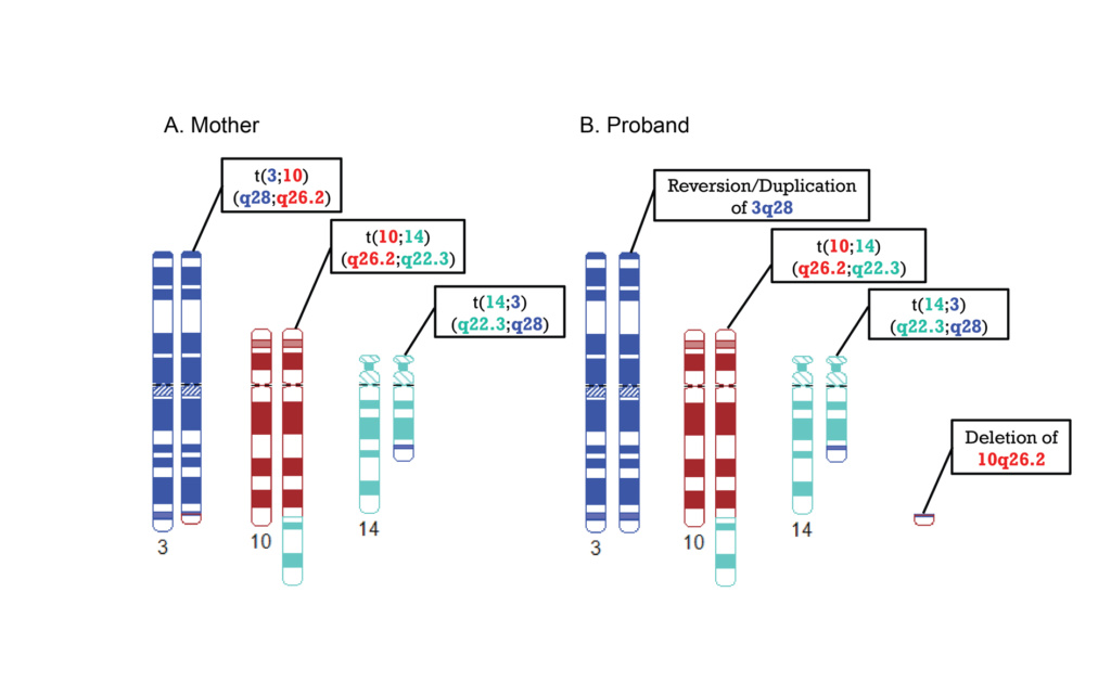 Schematic representation of complex translocations in mother and proband.