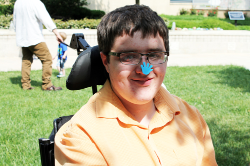 Matthew sitting in a wheelchair, with a blue hand sticker on his nose.