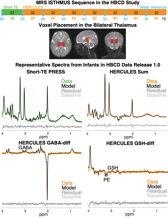 MRS Isthmus in HBDC Study