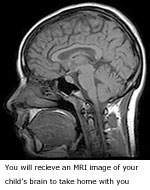 mri3.jpg