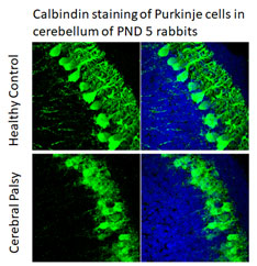 Calbindin-Staining