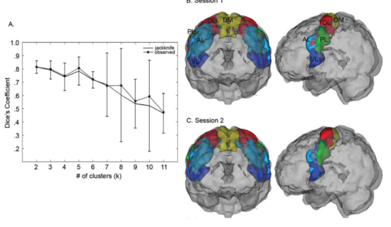 Neuroimage