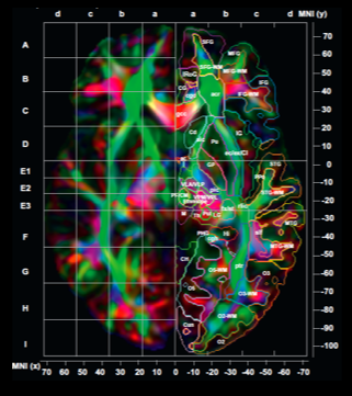 Diffusion Tensor Imaging