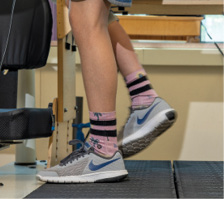 A photo of Brayden's legs as he uses a Bioness device while walking on a treadmill during physical therapy at Kennedy Krieger. The device delivers functional electrical stimulation to Brayden's right leg to improve his gait.