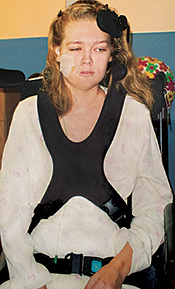 Amy, about three months after her surgery, in a custom-made wheelchair at Kennedy Krieger’s inpatient hospital.