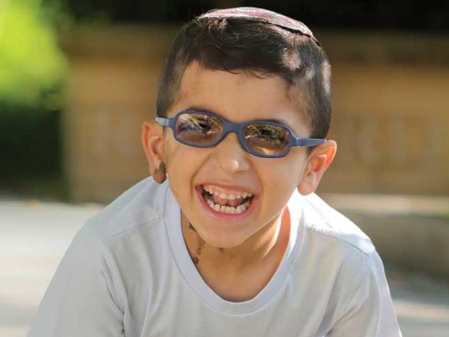 A young boy laughs and smiles while playing outside. He wears glasses and a kippa, and has a birthmark on his right ear and on the right side of his neck.