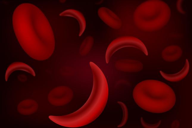Red blood cells of sickle cell anaemia disease