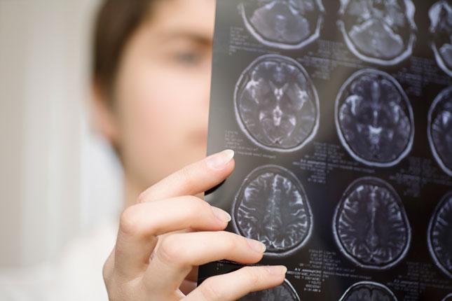 Primer plano de un médico mirando los resultados de un estudio por imágenes del cerebro.
