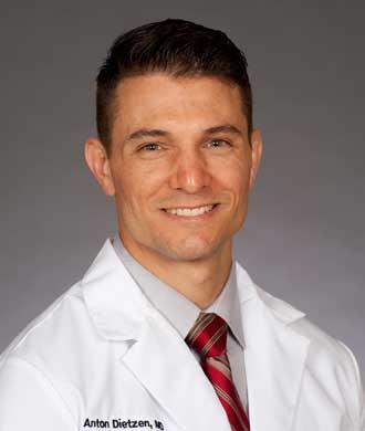 Anton Dietzen