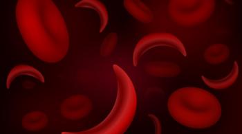 Red blood cells of sickle cell anaemia disease