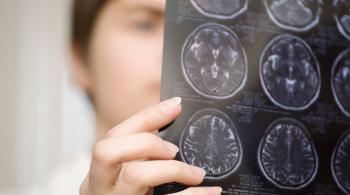 Closeup of a doctor looking at the results of a brain scan.