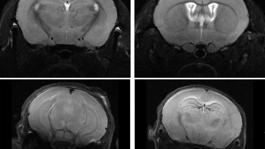 High Resolution Neuroanatomy 