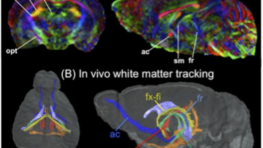 Diffusion Tensor Imaging (DTI) 